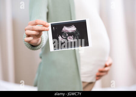Pregnant woman holding ultrasound scan of baby and touching belly Stock Photo