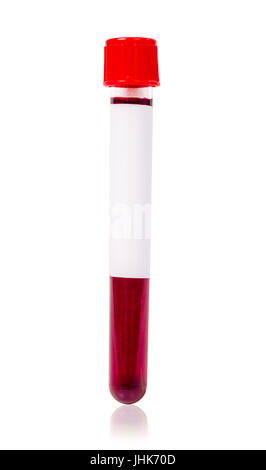 Sterile medical sample container with red lid on white background Stock ...