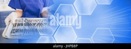 Digital composite of Close up of dentist with trays and blue smart tech transition Stock Photo