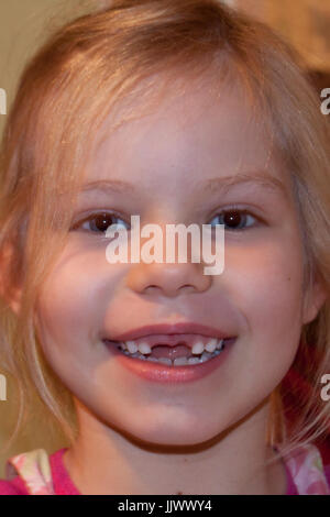 A portrait of a young smiling girl with her middle teeth mising Stock Photo