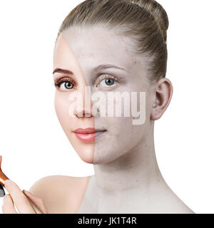 Young woman with acne before and after treatment. Stock Photo