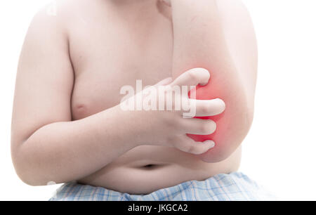 obese fat boy scratch the itch with hand / arm itching isolated on white background, Concept with Healthcare And Medicine.
