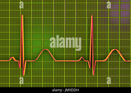 Computer artwork of an ECG (electrocardiogram) trace from an Stock ...