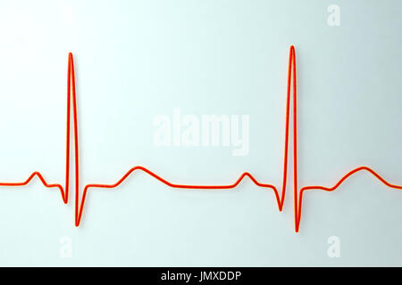 Computer artwork of an ECG (electrocardiogram) trace from an unhealthy ...