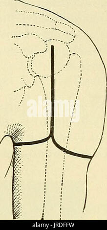 'A manual of modern surgery : an exposition of the accepted doctrines and approved operative procedures of the present time, for the use of students and practitioners' (1899) Stock Photo