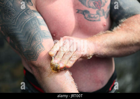 Scotland's John Pollock applies tacky during the Ultimate Strongman Masters World Championship final at Crumlin Road Gaol in Belfast. Stock Photo