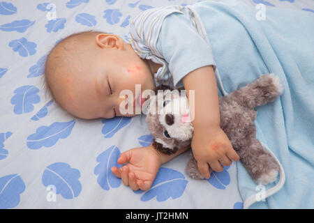 Sleeping Asian baby with red spot from mosquito bite on a cheek and hand, Cute 12 months old toddler boy taking a nap while holding dog toy on the bed Stock Photo