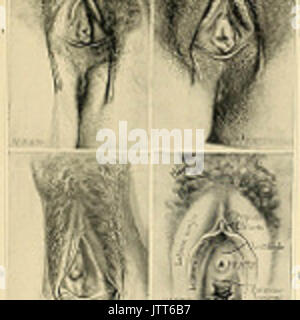 'An American text-book of obstetrics. For practitioners and students' (1897) Stock Photo