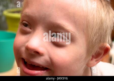 Happy boy with syndrome down after eating chocolate. Stock Photo
