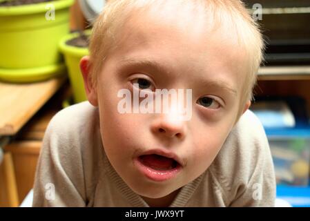Boy with down syndrome looking at the camera. Stock Photo