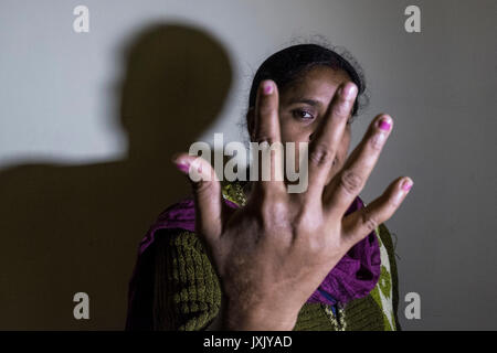 India, Kolkata, Women victims acid attack, portrait Stock Photo