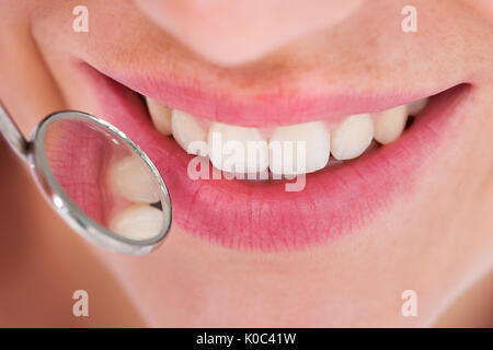 Closeup of young woman having her dental checkup Stock Photo