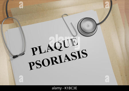 3D illustration of 'PLAQUE PSORIASIS' title on medical documents. Medicial concept. Stock Photo