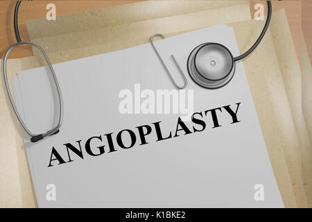 Render illustration of Angioplasty title on medical documents Stock Photo