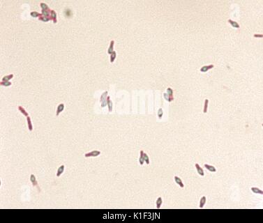 Clostridium botulinum spores stained with malachite green stain. The ...