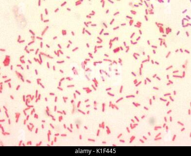 Yersinia pestis, Gram-negative bacillus, 1000x Magnification. Y. pestis ...