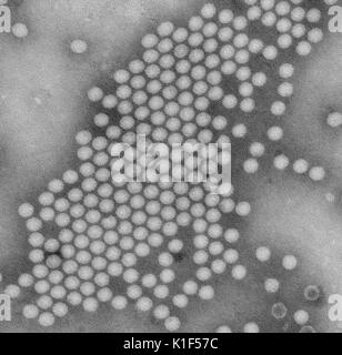 Transmission electron micrograph, negative stain image of the polio virus. Image courtesy CDC/J. J. Esposito, F. A. Murphy, 1971. Stock Photo