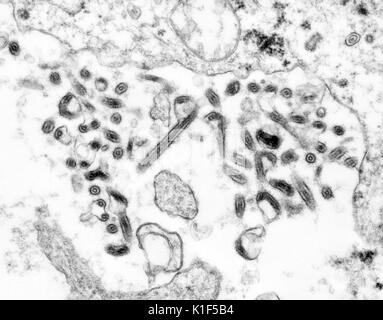 Created by Centers for Disease Control and Prevention (CDC) microbiologist Cynthia Goldsmith, this transmission electron micrograph (TEM) revealed some of the ultrastructural morphology displayed by a number of Ebola virus virions. Ebola is a severe, often-fatal disease in humans and nonhuman primates (monkeys, gorillas, and chimpanzees) that has appeared sporadically since its initial recognition in 1976. Image courtesy CDC/Cynthia Goldsmith. 1990. Stock Photo