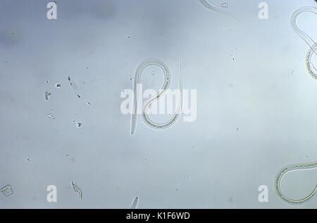 Under a magnification of 128X, this photomicrograph revealed the ...
