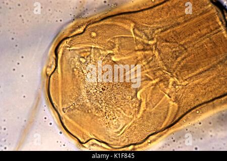 Computer illustration of the head of the parasitic hookworm Ancylostoma  duodenale. This is one of the commonest causes of hookworm infestation in  humans, particularly in sub-tropical regions such as North Africa and