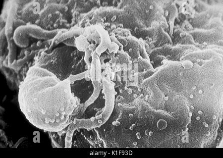 Scanning electron micrograph of HIV-1 virions budding from a cultured lymphocyte. See PHIL 10000 for a colorized view of this image, and PHIL 14270, for a black and white version, both viewed at a lower magnigication. Multiple round bumps on cell surface represent sites of assembly and budding of virions. Image courtesy CDC/C. Goldsmith, P. Feorino, E. L. Palmer, W. R. McManus. 1974. Stock Photo