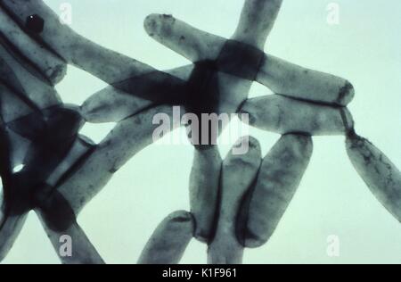 Under a magnification of 43, 700X, this transmission electron micrograph (TEM) created from a whole preparation of Legionella pneumophila bacteria that had been negatively stained using uranyl acetate, and grown on bacteriologic medium, reveals L. pneumophila organisms reproducing, undergoing the process of cell division, as well as delineating the bacterium?s outer envelope. Legionnaires' disease can have symptoms like many other forms of pneumonia, so it can be hard to diagnose at first. Signs of Legionnaires' disease can include:. Image courtesy CDC/Dr. Francis Chandler, 1978. Stock Photo