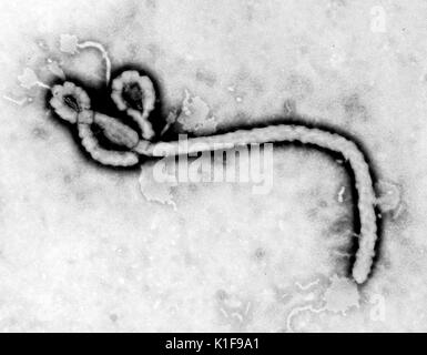 Created by CDC microbiologist Frederick A Murphy, this transmission electron micrograph (TEM) revealed some of the ultrastructural morphology displayed by an Ebola virus virion See PHIL 10815 for a colorized version of this image, Ebola is a severe, often-fatal disease in humans and nonhuman primates (monkeys, gorillas, and chimpanzees) that has appeared sporadically since its initial recognition in 1976 Image courtesy CDC/Frederick A Murphy, 1976. Stock Photo
