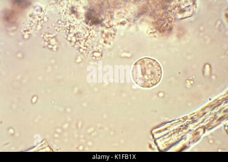 This photomicrograph depicts a cyst of an Entamoeba histolytica amoebic ...