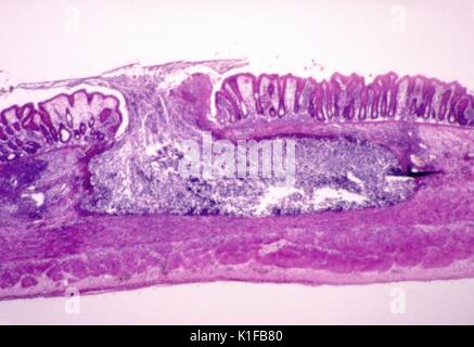 Human intestine tissue, light micrograph Stock Photo - Alamy