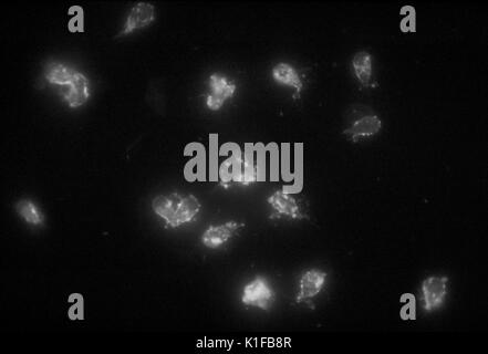This photomicrograph depicts a positive indirect fluorescent antibody (IFA) test for Giardia lamblia parasites. Image courtesy CDC/Dr. Govinda S. Visvesvara, 1978. Stock Photo