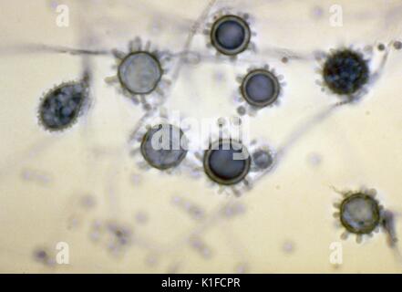 Asexual spores (conidia): tuberculate macroconidia of Histoplasma capsulatum . Microconidia are also present. Image courtesy CDC. 1982. Stock Photo