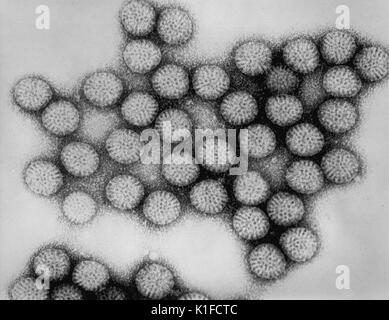 This transmission electron micrograph (TEM) depicted numbers of intact rotavirus double-shelled particles. Note the distinctive rim of radiating capsomeres. See PHIL 178 for a colorized version of this image. Image courtesy CDC/Dr. Erskine Palmer, 1981.