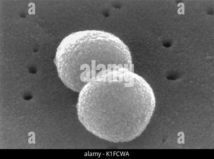 Scanning electron micrograph (SEM) of a number of Gram-positive Streptococcus pneumoniae bacteria. Image courtesy CDC/Dr. Richard Facklam. 1982. Stock Photo