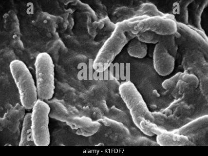 Scanning electron micrograph (SEM) of Pseudomonas aeruginosa bacteria ...