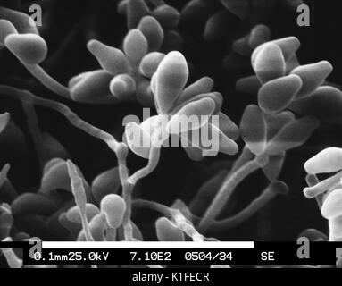 This scanning electron micrograph (SEM) depicts a magnified view of a colony of the dematiaceous filamentous fungus Curvularia geniculata, revealing the morphologic details of the organism?s hyphae, and conidiophores topped with spore-containing conidia. Though normally found living in soil or decaying vegetation, Curvularia geniculata is pathogenic to humans, causing wound infections known as phaeohyphomycosis, which are fungal infections that can involve a number of bodily structures including the skin, respiratory tract, and brain, to name a few. Image courtesy CDC/Robert Simmons, Janice Ha Stock Photo