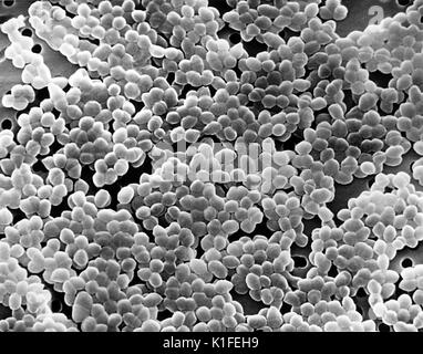 This scanning electron micrograph (SEM) depicted large numbers of Gram-positive Enterococcus sp. bacteria. See PHIL 12802, for a digitally-colorized version of this image. Image courtesy CDC. 1990. Stock Photo