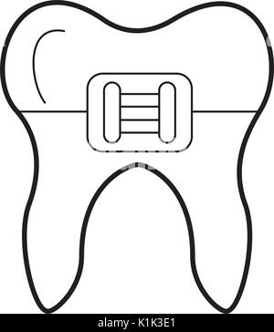 Human tooth with bracket Stock Vector Image & Art - Alamy
