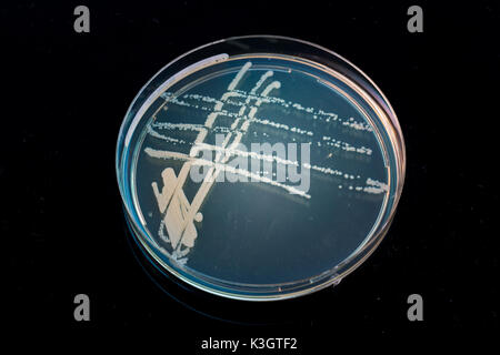 Pile petri dish with growing cultures of microorganisms in doctor hand , fungi and microbes. A Petri dish  ( Petrie dish. Petri plate or cell-culture  Stock Photo