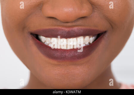 Close-up Photo Of Smiling Woman White Teeth Stock Photo