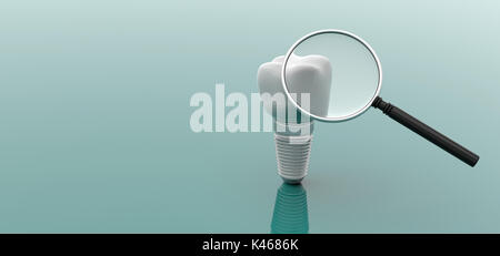 Dental implant and magnifying glass isolated on white background. 3d ...