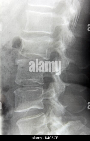Radiography Stock Photo