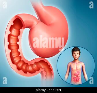 Illustration of a child's stomach and duodenum. Stock Photo