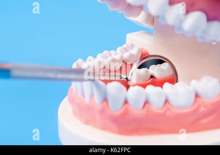 Tooth dental caries on denture with equipment dental. Dental concept ...