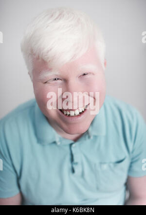 Albino young man portrait. Smiling guy isolated at white background. Albinism, pale skin. Stock Photo