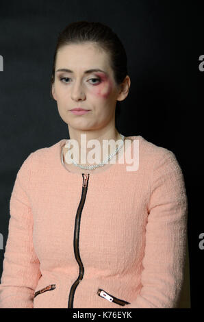 Home violence. Beaten woman with injuries on face, bleeding, black eye. Sad woman portrait. Stock Photo