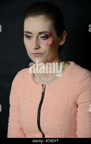 Home violence. Beaten woman with injuries on face, bleeding, black eye. Sad woman portrait. Stock Photo