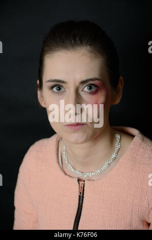 Home violence. Beaten woman with injuries on face, bleeding, black eye. Stock Photo