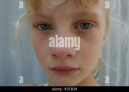 Portrait of a young girl in pain staring