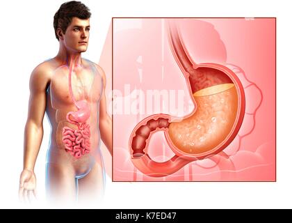 Illustration of man with stomach acidity. Stock Photo