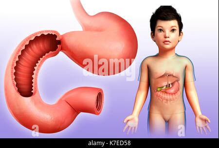 Illustration of a child's duodenum. Stock Photo